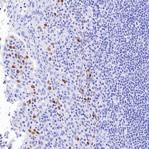 FOXA1 Recombinant Rabbit mAb (SDT-2779-17)
