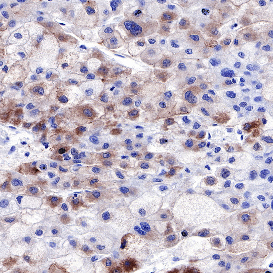 Glypican-3 Recombinant Rabbit mAb,PBS Only (SDT-R032)