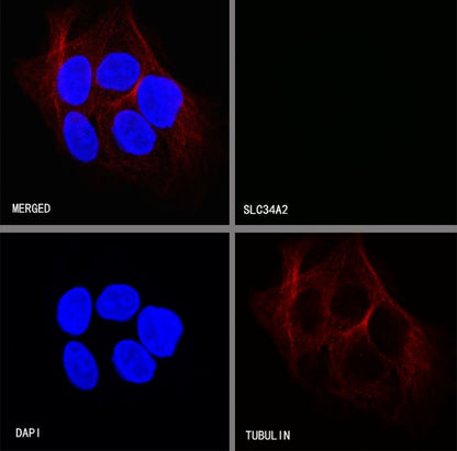 NaPi2b/SLC34A2 Recombinant Rabbit mAb (SDT-R229)