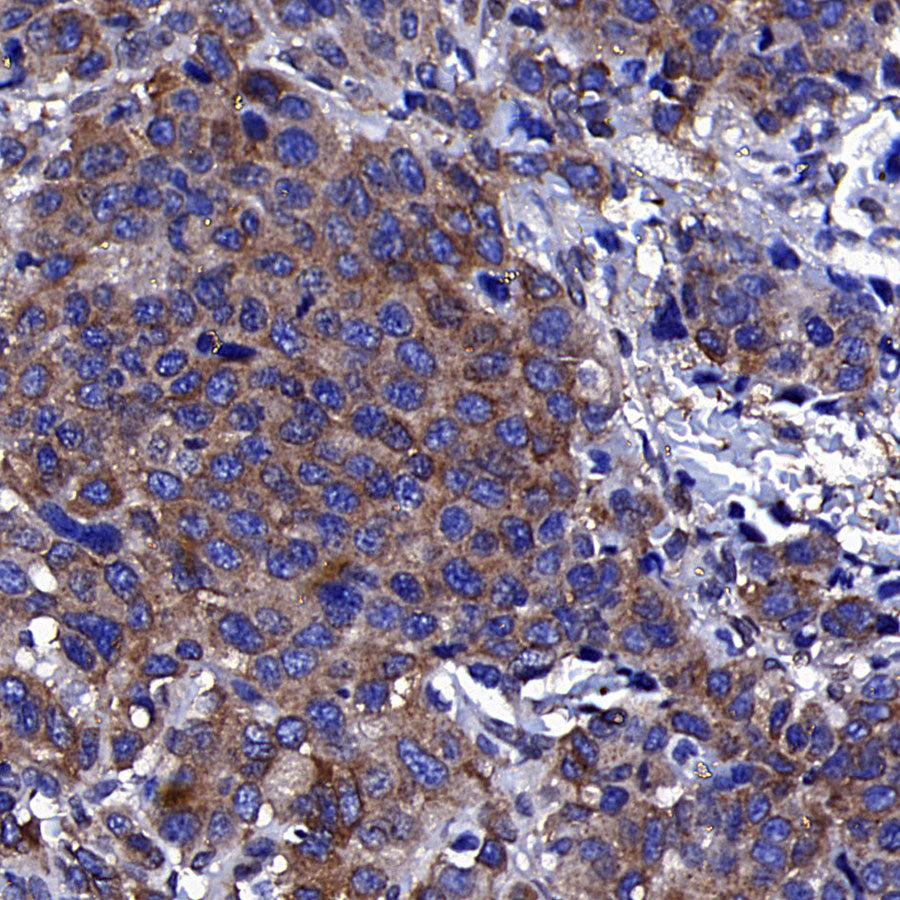 Golgin-245 Recombinant Rabbit mAb (S-4473-8)