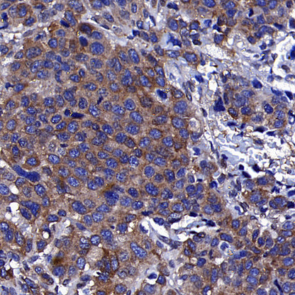 Golgin-245 Recombinant Rabbit mAb (S-4473-8)