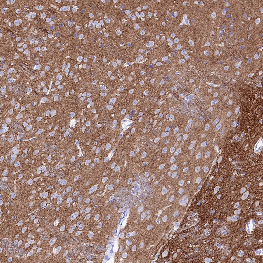 pan SCN Recombinant Rabbit mAb (S-5038)