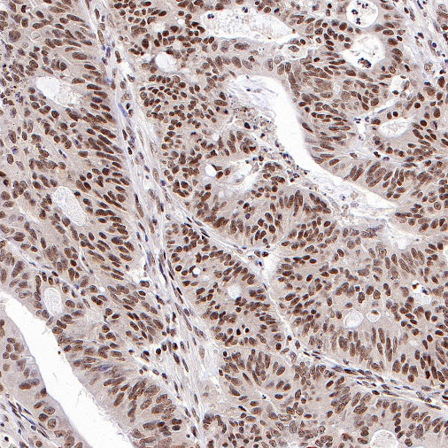 CTCF Recombinant Rabbit mAb (S-1822-42)