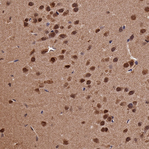 DYNLL1/PIN Recombinant Rabbit mAb (S-1460-8)