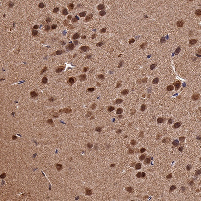 DYNLL1/PIN Recombinant Rabbit mAb (S-1460-8)