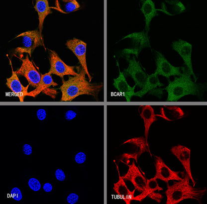 BCAR1 Recombinant Rabbit mAb (S-3542-49)
