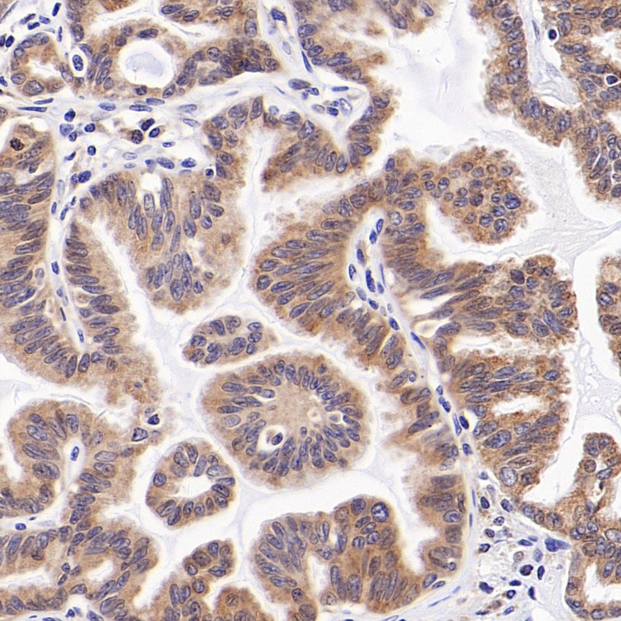 PDIA3 Rabbit Polyclonal Antibody