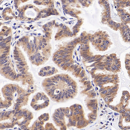 PDIA3 Rabbit Polyclonal Antibody