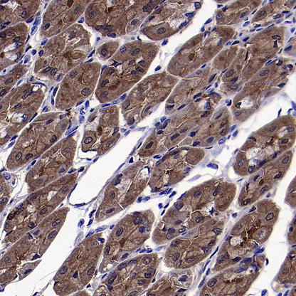 ADA Recombinant Rabbit mAb (S-5470)