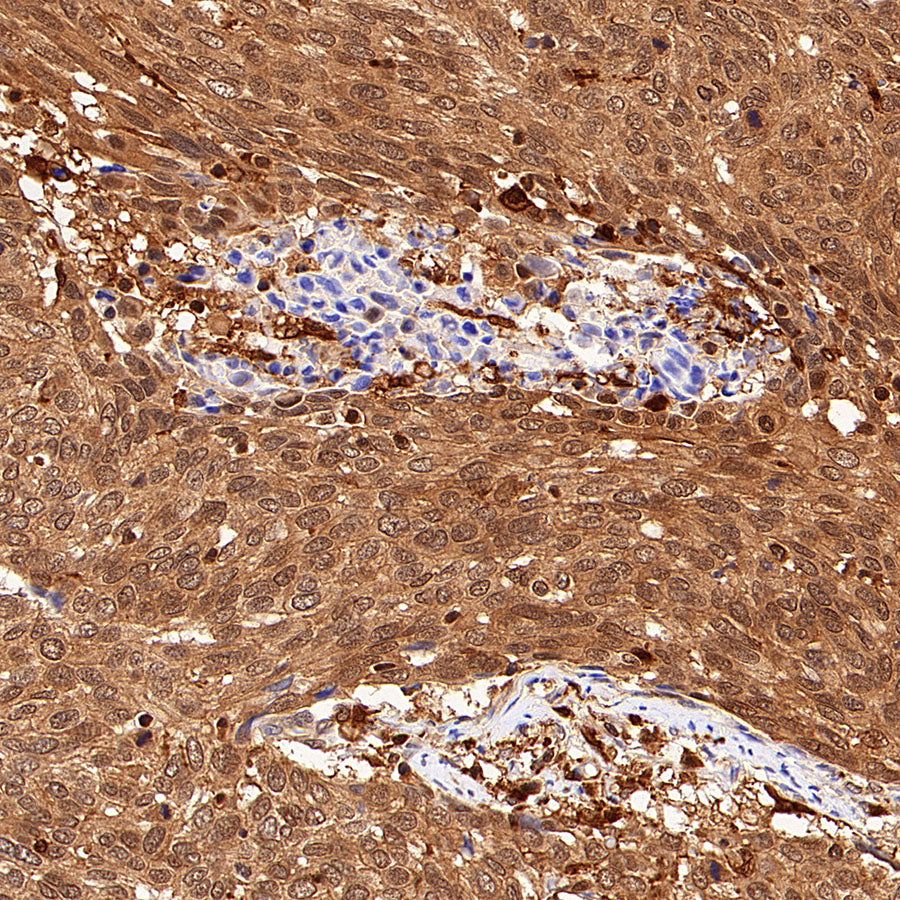 GRB2 Recombinant Rabbit mAb (S-5948)