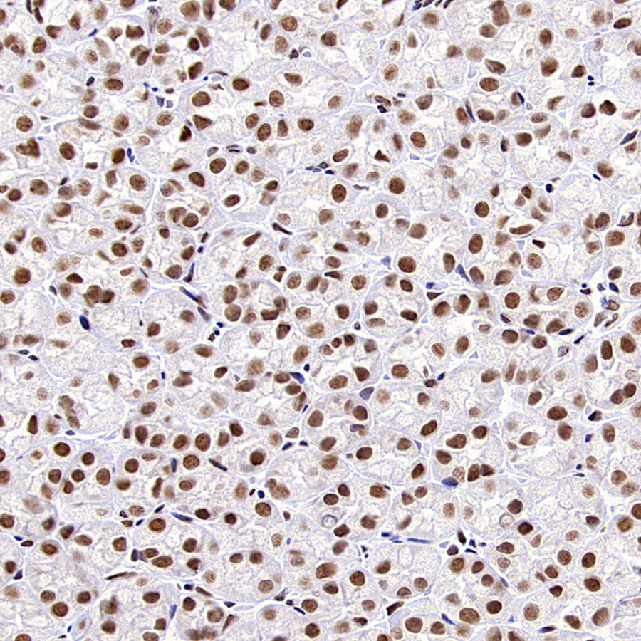 HNRNPL Rabbit Polyclonal Antibody