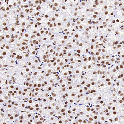 HNRNPL Rabbit Polyclonal Antibody
