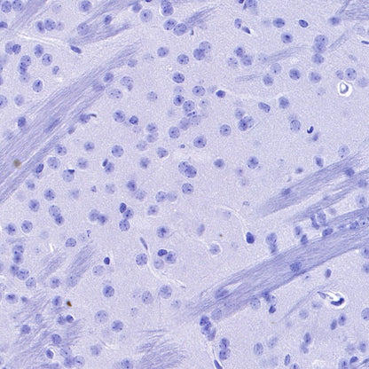 S-RMab®Rabbit mAb IgG Isotype Control (S-R058)