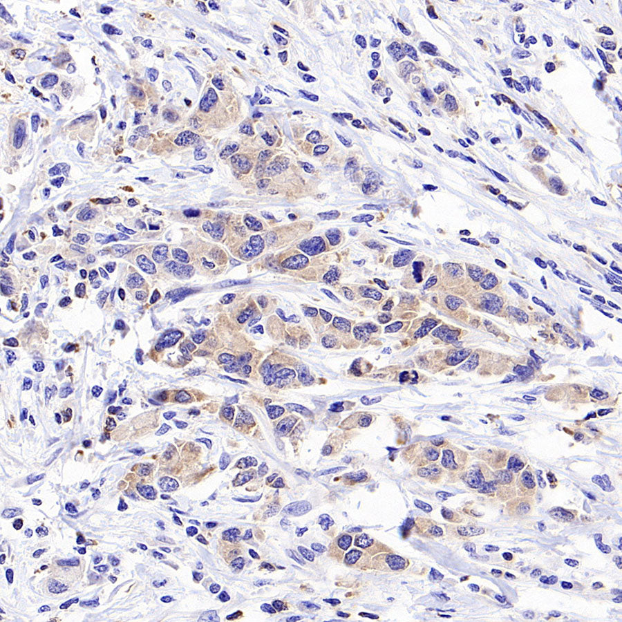 STK39 Recombinant Rabbit mAb (S-3630-15)