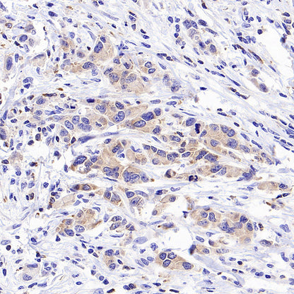 STK39 Recombinant Rabbit mAb (S-3630-15)