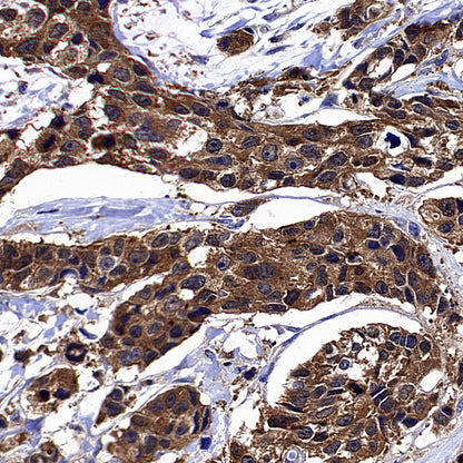 ARF6 Recombinant Rabbit mAb (S-4283-62)