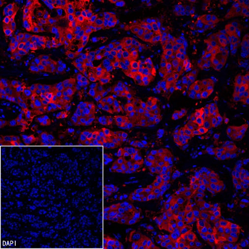 FASN Recombinant Rabbit mAb (PE Conjugate) (S-682-32)