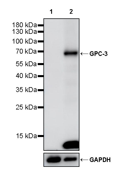 Glypican-3 Recombinant Rabbit mAb (SDT-4064-69-2)