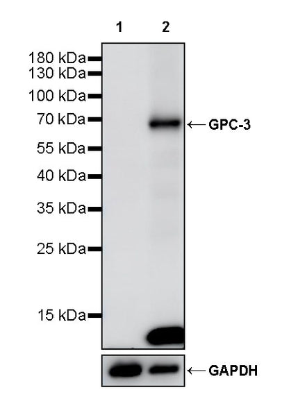 Glypican-3 Recombinant Rabbit mAb (SDT-4064-69-2)