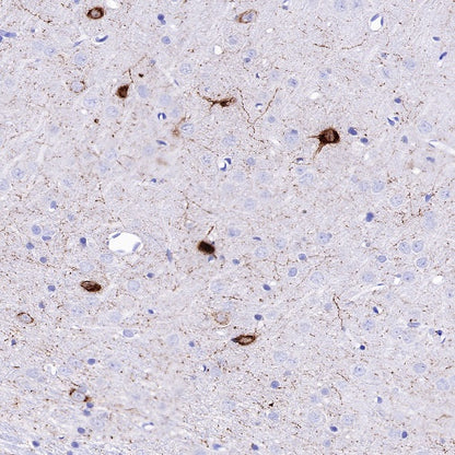 Neuropeptide Y Recombinant Rabbit mAb (S-1104-18)