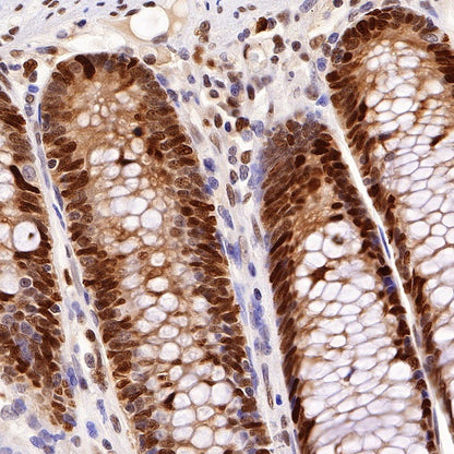 PCNA Recombinant Rabbit mAb (SDT-297-116)