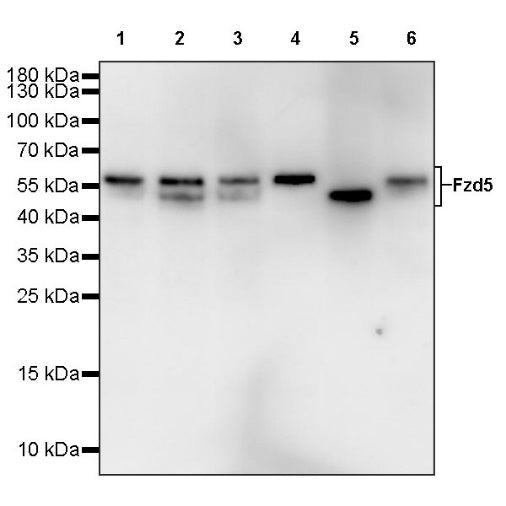 Fzd5 Recombinant Rabbit mAb (S-1511-106)