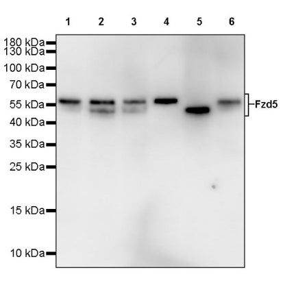 Fzd5 Recombinant Rabbit mAb (S-1511-106)