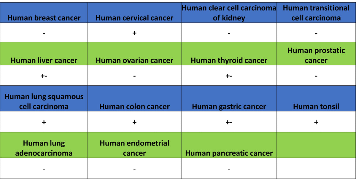 FoxO1 Recombinant Rabbit mAb (S-5118)