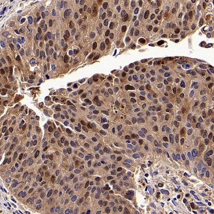 SERPINB3 Recombinant Rabbit mAb (S-4587)
