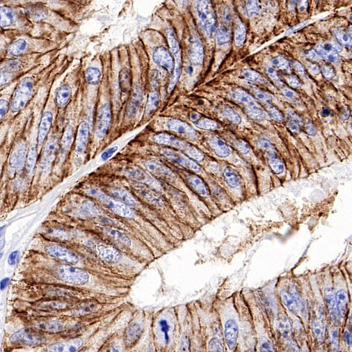 Claudin 3 Recombinant Rabbit mAb (S-819-131)