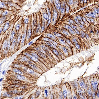 Claudin 3 Recombinant Rabbit mAb (S-819-131)