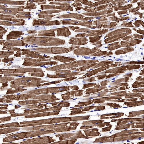 Cardiac troponin T (TNNT2) Recombinant Rabbit mAb (SDT-2894-34)