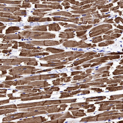 Cardiac troponin T (TNNT2) Recombinant Rabbit mAb (SDT-2894-34)