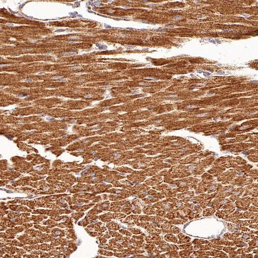 ATPB Rabbit Polyclonal Antibody
