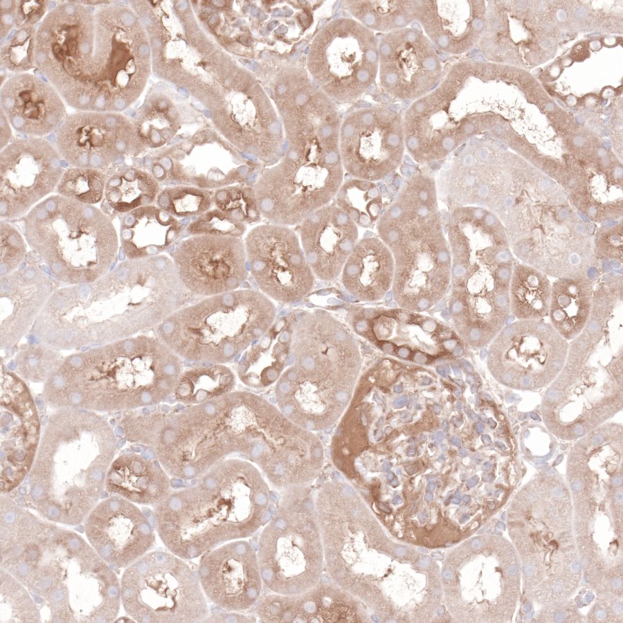 Hsp90 beta Recombinant Rabbit mAb (SDT-R033)