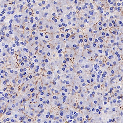 Claudin 5 Recombinant Rabbit mAb (SDT-R322)