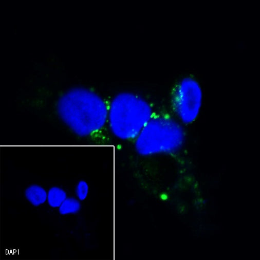 Cathepsin D Recombinant Rabbit mAb (S-R208)