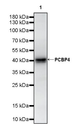 PCBP4 Recombinant Rabbit mAb (S-3107-175)