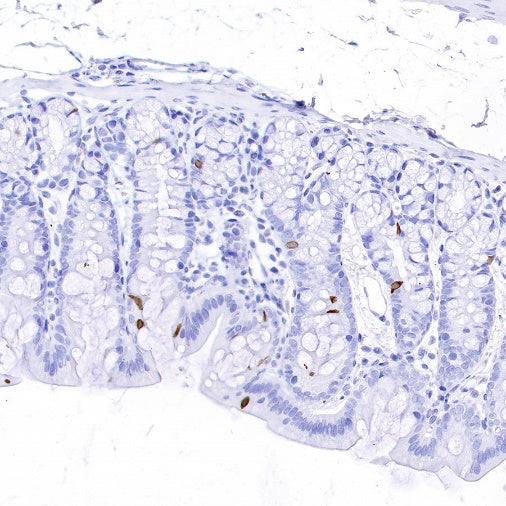 DCAMKL1 Recombinant Rabbit mAb (S-1705-76)