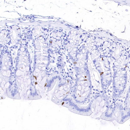 DCAMKL1 Recombinant Rabbit mAb (S-1705-76)