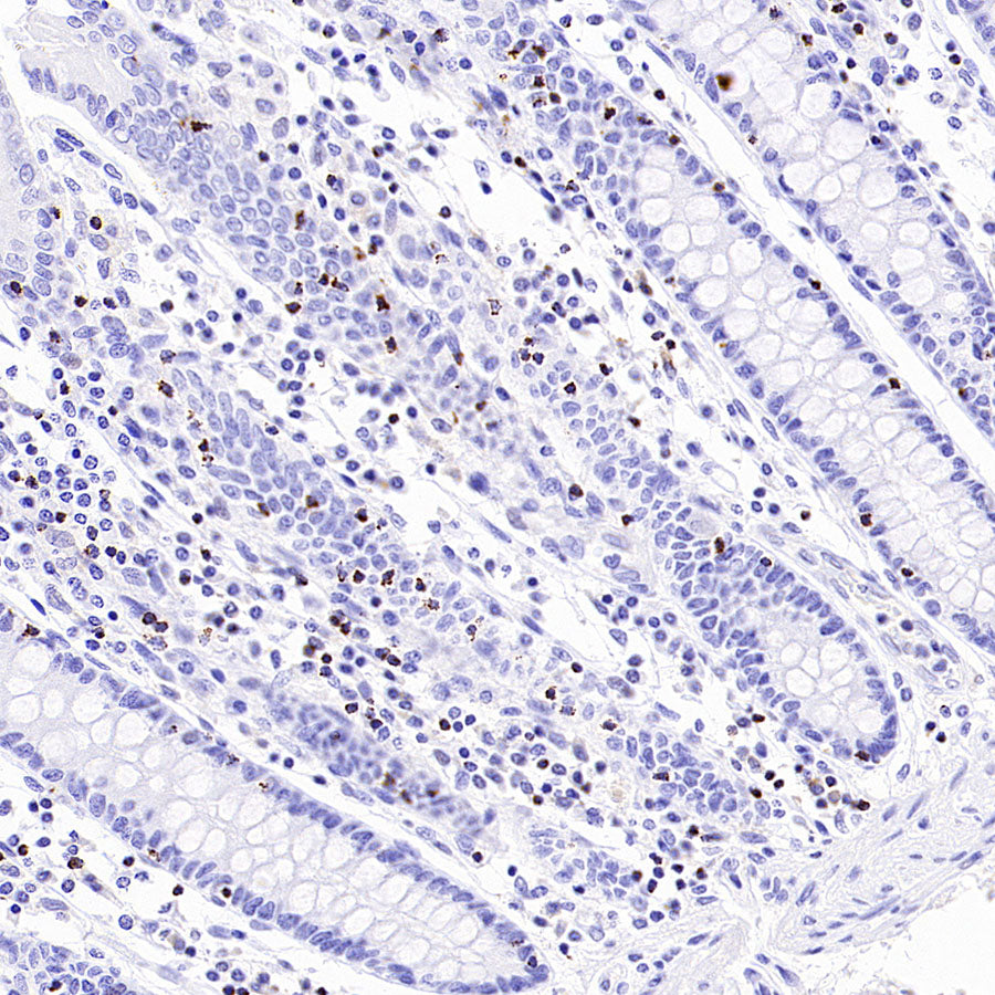 CCL18 Recombinant Rabbit mAb (S-2788-25)