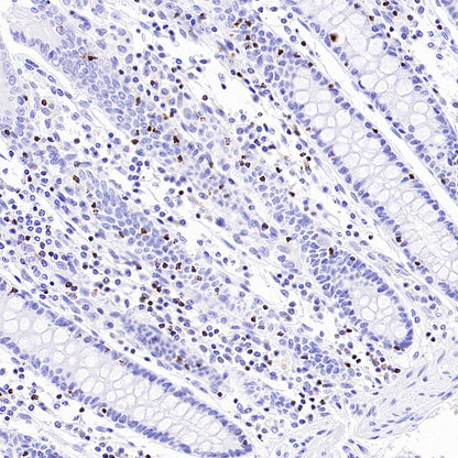 CCL18 Recombinant Rabbit mAb (S-2788-25)