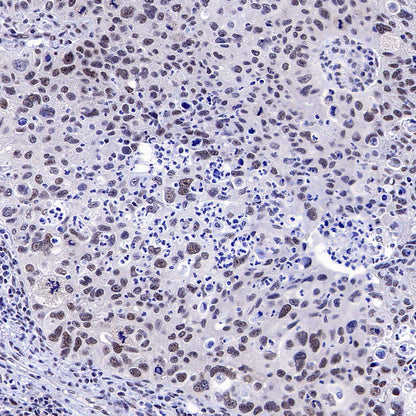 DGCR8 Recombinant Rabbit mAb (S-4082-6)