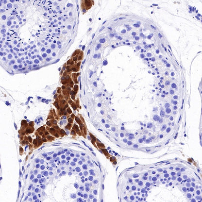 Stat5 Recombinant Rabbit mAb (S-R234)