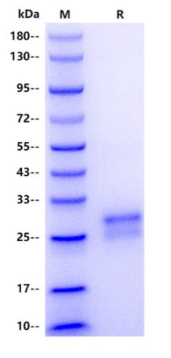 Mouse TL1A/TNFSF15 Protein, His tag