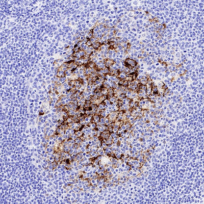 Calbindin Recombinant Rabbit mAb (S-774-378)