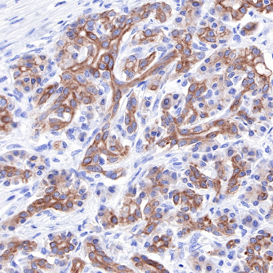 Keratin 18 Recombinant Rabbit mAb (SDT-R081)