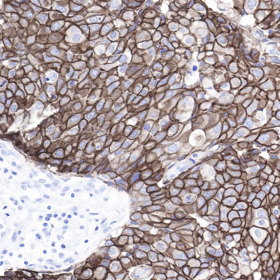 ErbB2 Recombinant Rabbit mAb (SDT-069-10)