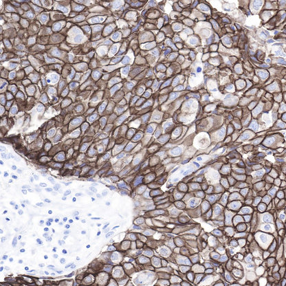 ErbB2 Recombinant Rabbit mAb (SDT-069-10)