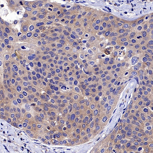 Hamartin/TSC1 Recombinant Rabbit mAb (S-2725-166)